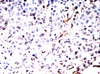 NR2F2 Antibody