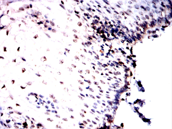 NR2F2 Antibody