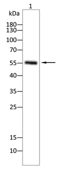 CAMK2D Antibody