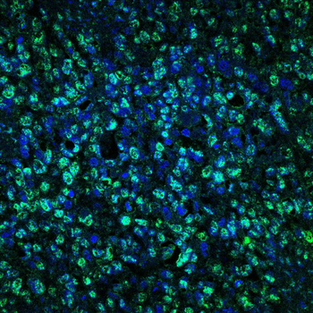 CSNK1A1/CSNK1A1L Antibody