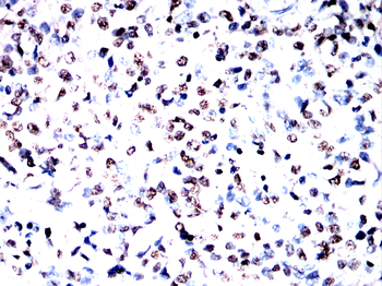 CSNK1A1/CSNK1A1L Antibody