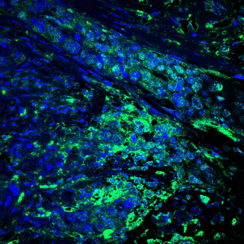 ACTA1 Antibody