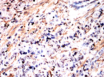 ACTA1 Antibody