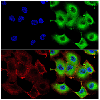 Glutathione Peroxidase 3 Rabbit Polyclonal Antibody