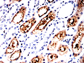 Glutathione Peroxidase 3 Rabbit Polyclonal Antibody