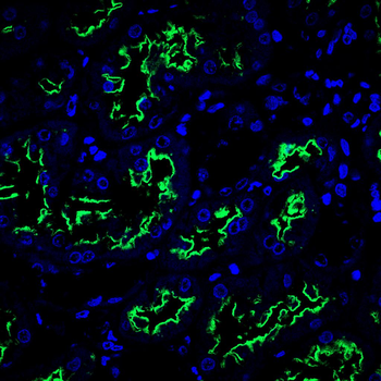Glutathione Peroxidase 3 Rabbit Polyclonal Antibody