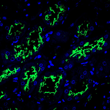 Glutathione Peroxidase 3 Rabbit Polyclonal Antibody