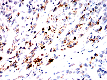 Glutathione Peroxidase 3 Rabbit Polyclonal Antibody