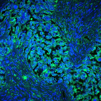 ATP6V1A Antibody