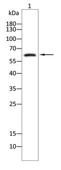 IGF2BP3 Antibody