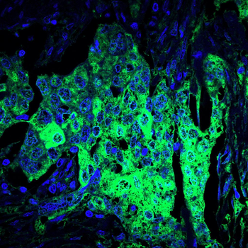 IGF2BP3 Antibody