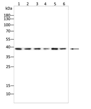 NDEL1 Antibody
