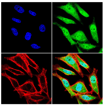 YTHDF2 Rabbit Polyclonal Antibody