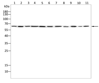 YTHDF2 Rabbit Polyclonal Antibody