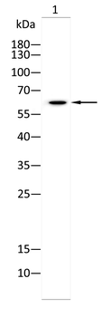 YTHDF2 Rabbit Polyclonal Antibody