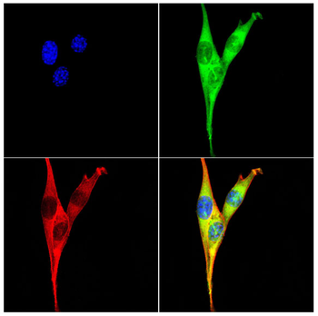 YTHDF2 Rabbit Polyclonal Antibody