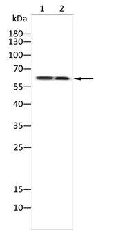 YTHDF2 Rabbit Polyclonal Antibody