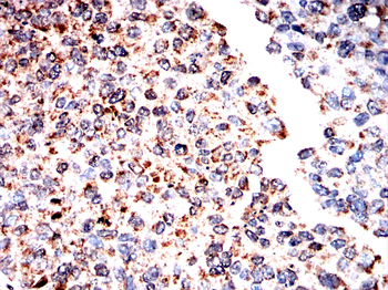 DLAT Antibody