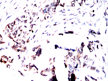 PRDM16 Antibody