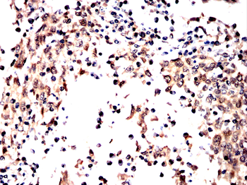 PRDM16 Antibody