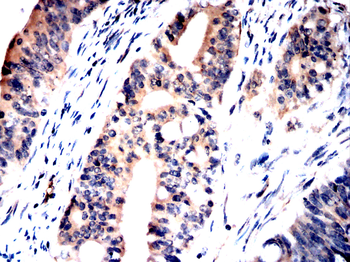 PRDM16 Antibody