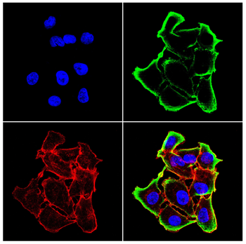 P2RX7 Antibody