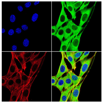 P2RX7 Antibody