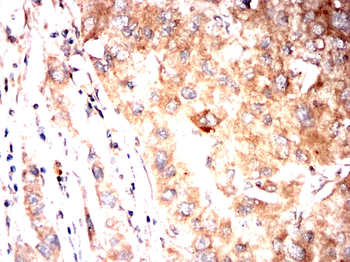 P2RX7 Antibody