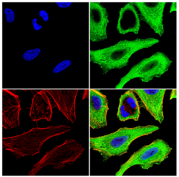 ATG14L Rabbit Polyclonal Antibody