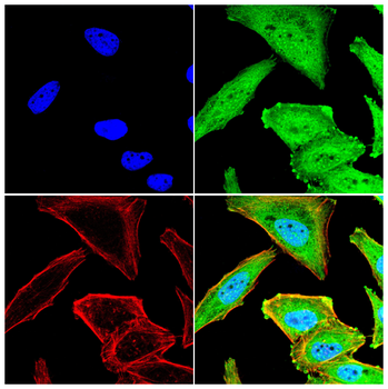 DDX20 Antibody