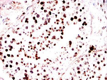 DDX20 Antibody