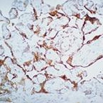 VEGF R3 (Flt-4) Antibody