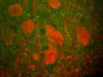 PGP9.5/UCHL1 Antibody