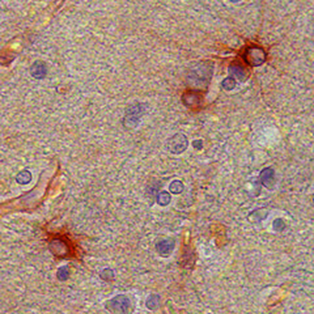 BACE1 Antibody