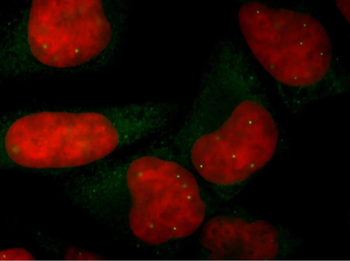 SMN/Gemin-1 Monoclonal Antibody