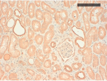 Cytokeratin (pan) basic type 2 Monoclonal Antibody