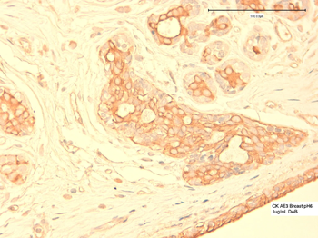 Cytokeratin (pan) basic type 2 Monoclonal Antibody