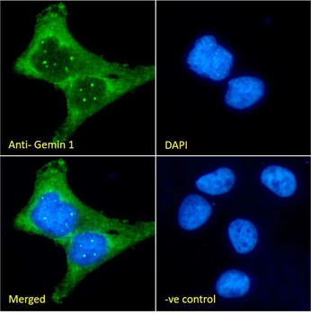 SMN/Gemin-1 Monoclonal Antibody