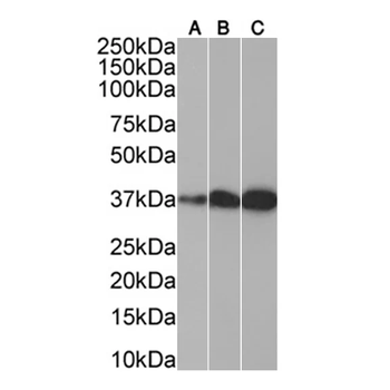 SMN/Gemin-1 Monoclonal Antibody