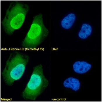 Histone H3 (tri methyl K9) Mouse Monoclonal Antibody