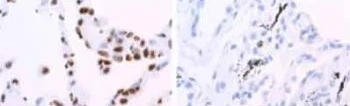 hnRNP A1 Monoclonal Antibody