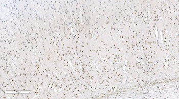 Aryl hydrocarbon Receptor/AHR Antibody