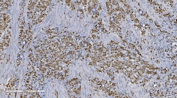 Aryl hydrocarbon Receptor/AHR Antibody