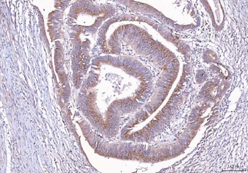 ALDH3A1 Rabbit Polyclonal Antibody