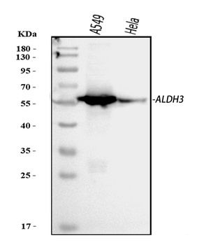 ALDH3A1 Rabbit Polyclonal Antibody