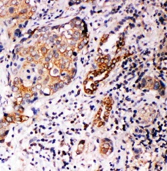 Annexin A10/ANXA10 Rabbit Polyclonal Antibody