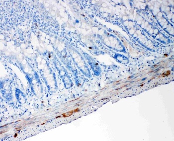 PC1/3/PCSK1 Rabbit Polyclonal Antibody