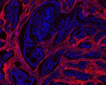 Collagen I/COL1A1 Antibody