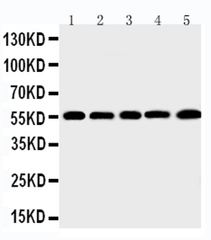 Macrophage metalloelastase MMP12 Rabbit Polyclonal Antibody