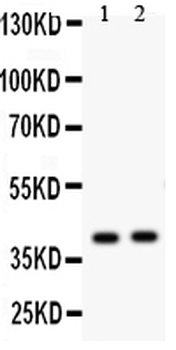 Protein NDRG2 NDRG2 Rabbit Polyclonal Antibody